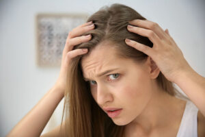 درمان ریزش هورمونی مو در خانم ها