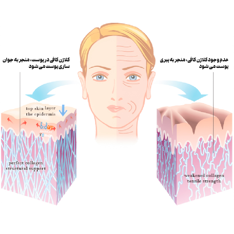 اهمیت کلاژن سازی پوست