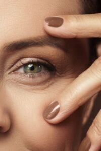 درمان چین و چروک اطراف چشم