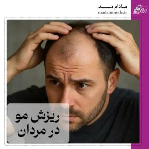 تصویر شاخص ریزش مو در مردان